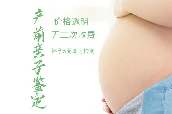 嘉兴如何做胎儿亲子鉴定,