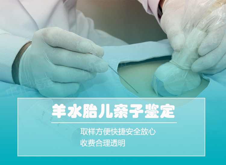 嘉兴羊水孕期亲子鉴定